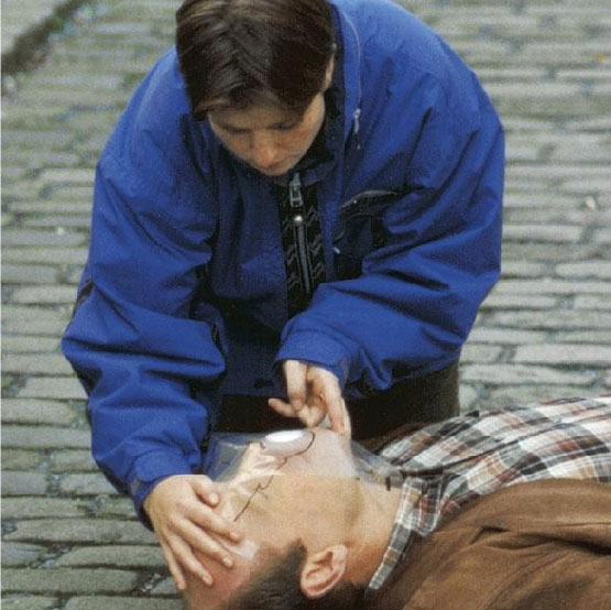 CPR Face Shield